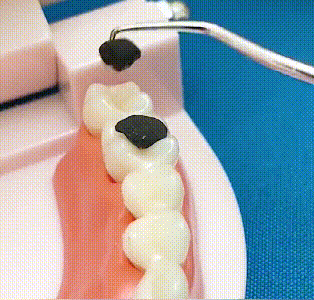 🦷Rozsdamentes acél fogpiszkáló készlet🔥