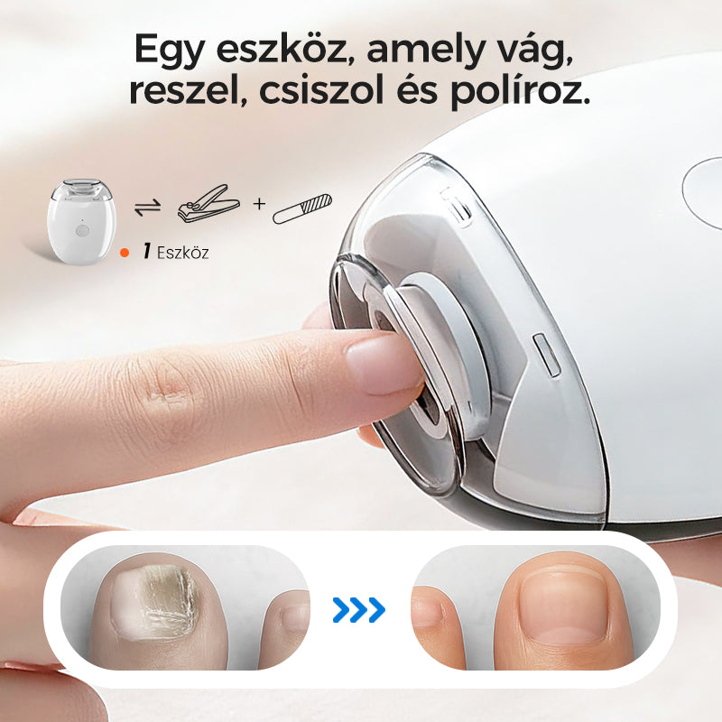🎁 1+1 ingyenes! Univerzális automata körömreszelő – felnőtteknek és gyerekeknek egyaránt! 💅 Platás utánvéttel!