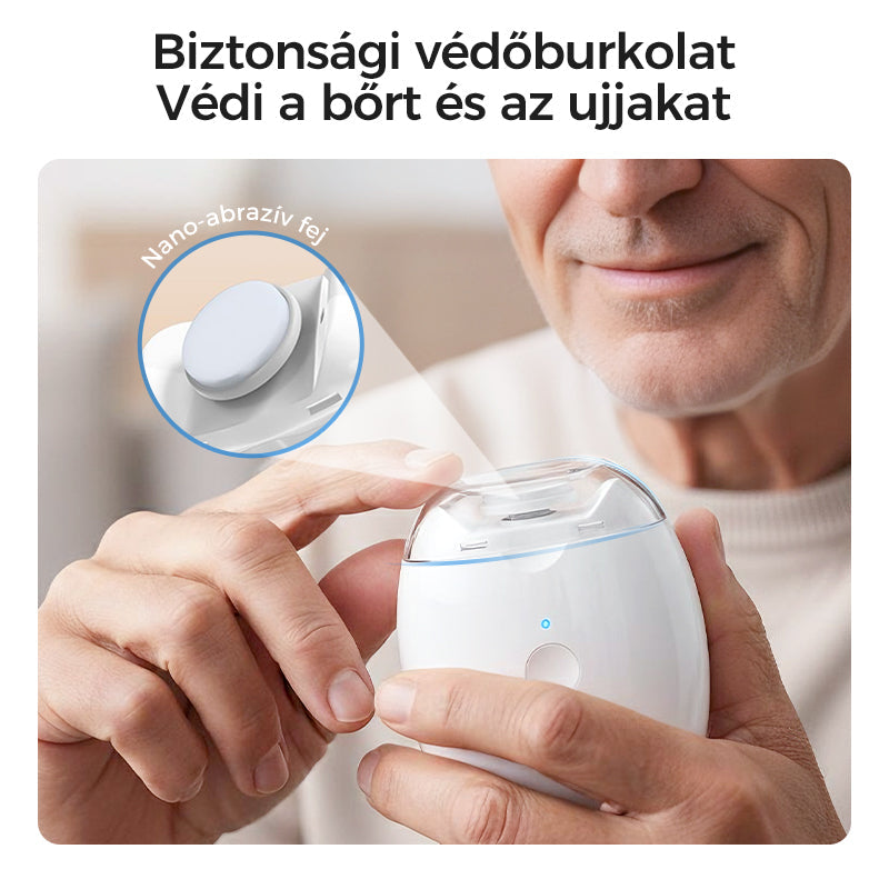 🎁 1+1 ingyenes! Univerzális automata körömreszelő – felnőtteknek és gyerekeknek egyaránt! 💅 Platás utánvéttel!