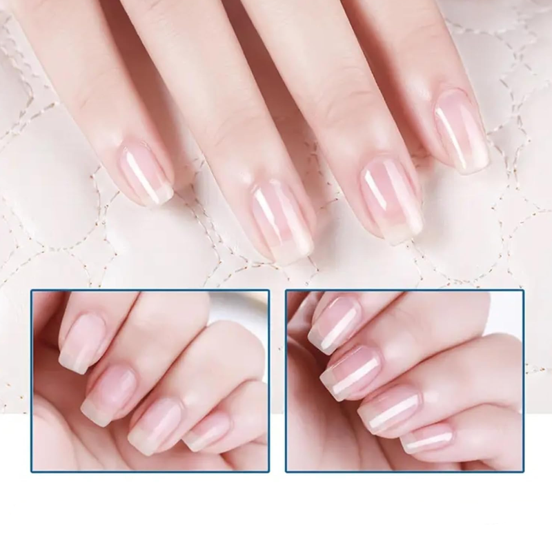 💅✨ Fényes, gyorsan száradó, tápláló körömápoló olaj – pár másodperc alatt szép, egészséges köröm! Utánvéttel!