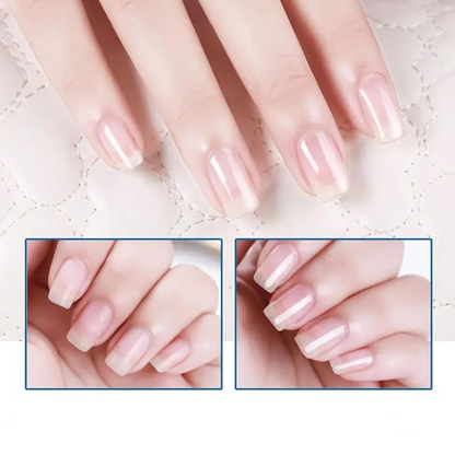 💅✨ Fényes, gyorsan száradó, tápláló körömápoló olaj – pár másodperc alatt szép, egészséges köröm! Utánvéttel!
